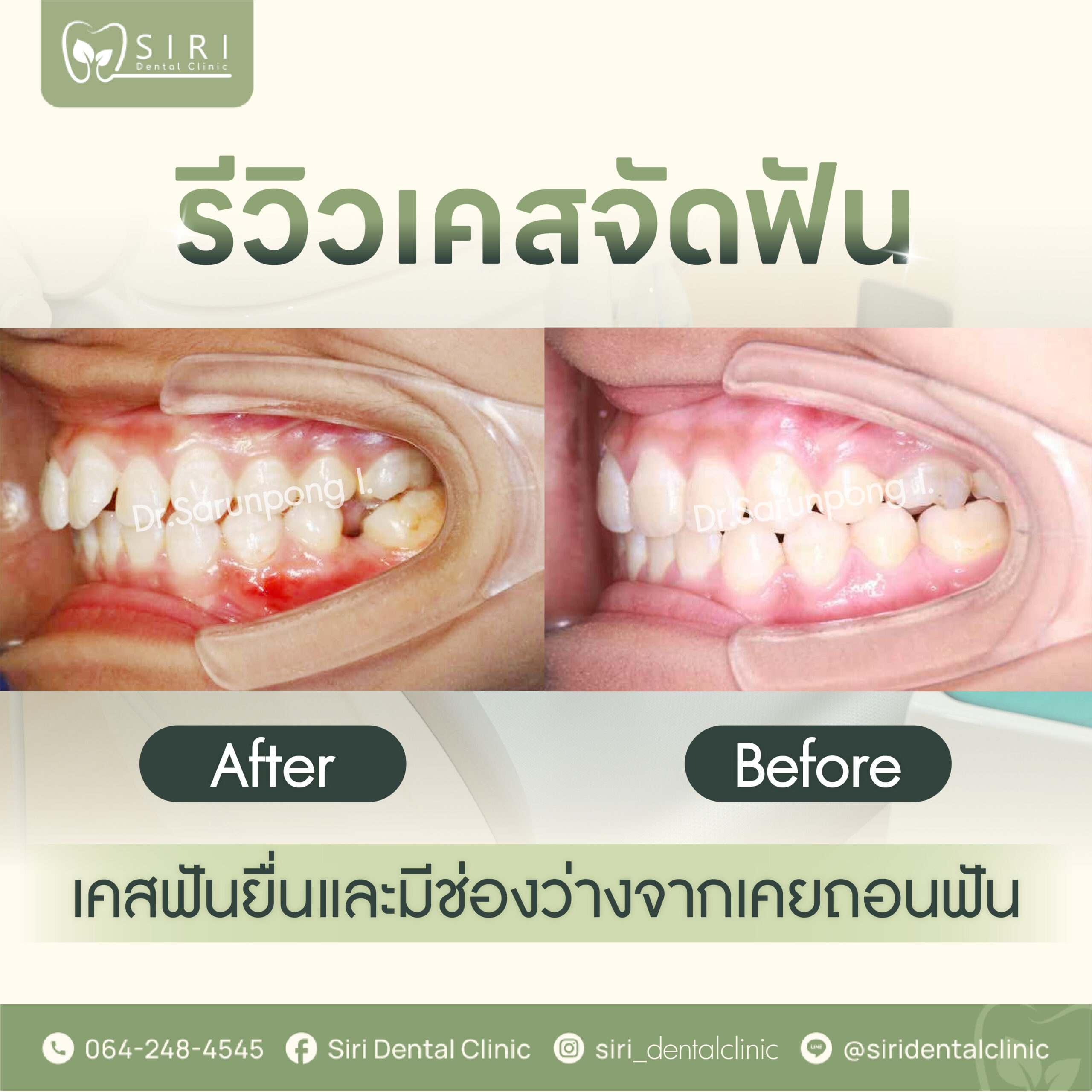 รวมคลินิก siri,brignt,smile-04