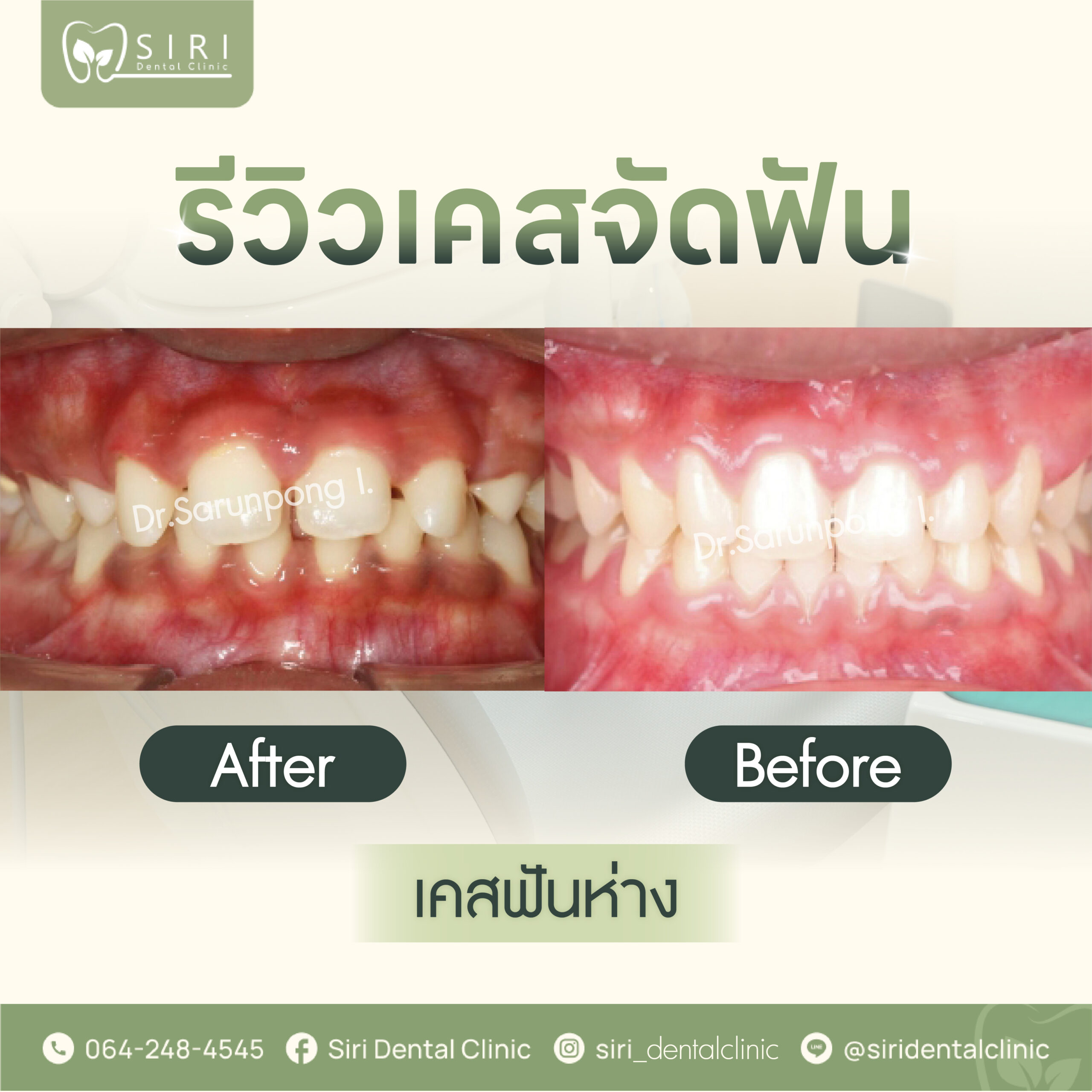 รวมคลินิก siri,brignt,smile-05