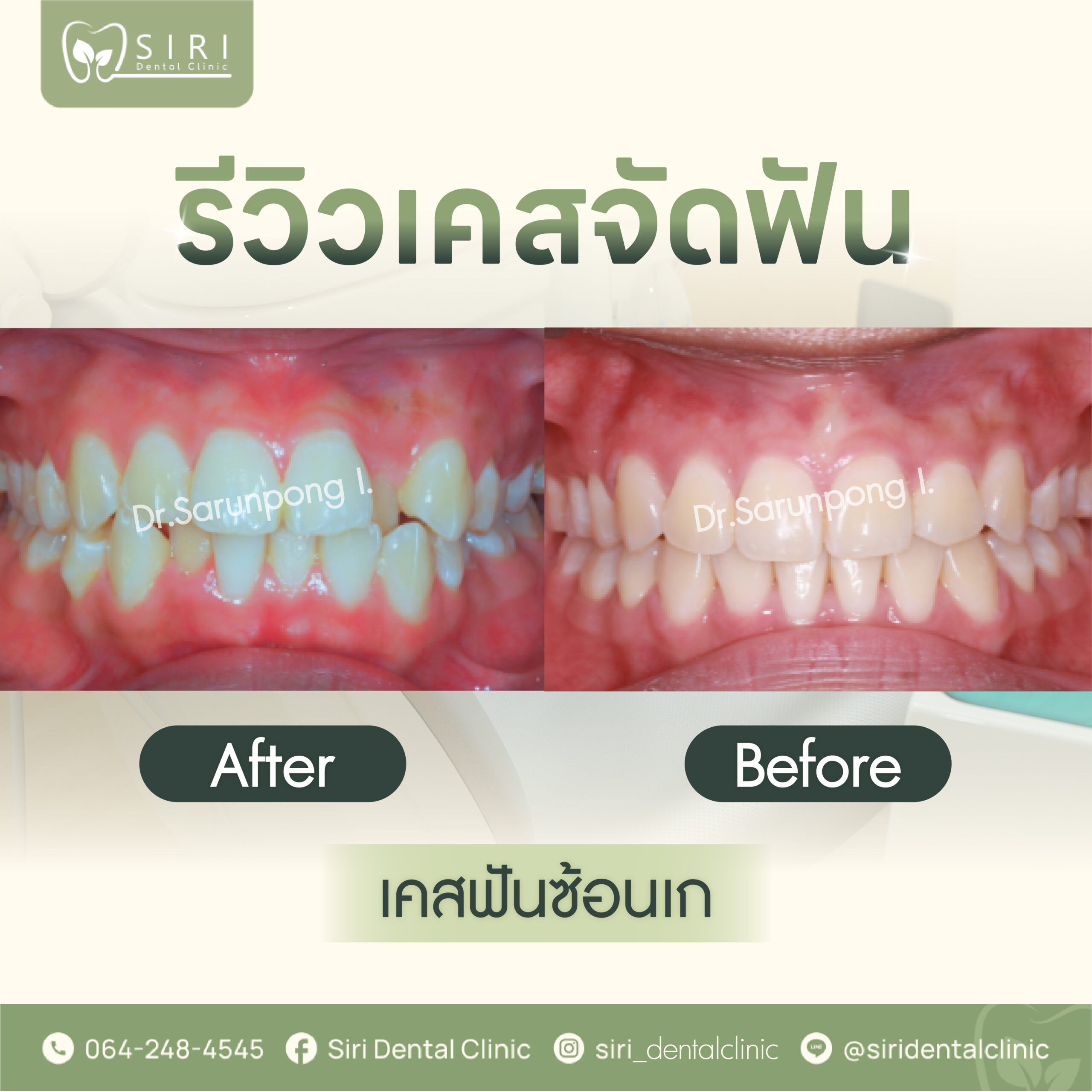 รวมคลินิก siri,brignt,smile-06